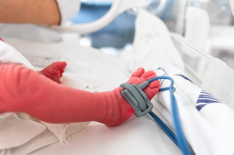 Premature baby foot with a neonatal pulse oximetry monitor, selective focus