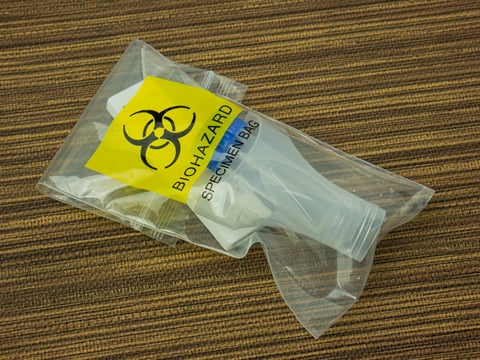 Bolsa extractora laparoscópica endo catch para cirugía mínimamente invasiva