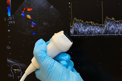Transductor Lineal MultiFrecuencia para Vetus 5