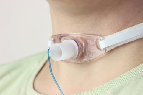 Cánula de traqueostomía adulto flexible con globo 10.0mm
