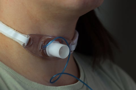 Cánula Shiley para traqueostomía fenestrada con cánula interna desechable DCT