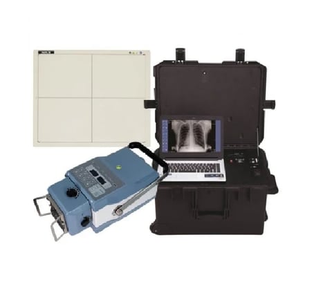 Mobile X-ray system with portable blue imaging unit, black carrying case with laptop displaying chest X-ray, and beige control panel