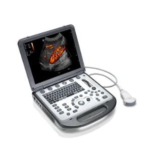 Portable ultrasound machine with color display and attached probe, used for medical imaging diagnostics