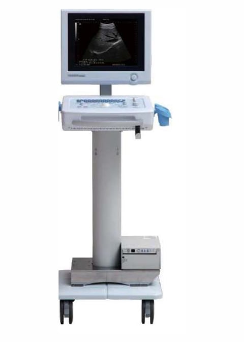 Medical ultrasound machine on wheeled cart with monitor displaying sonogram image