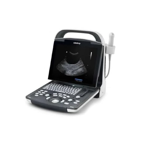 Portable ultrasound machine displaying fetal sonogram image on screen with control panel and attached probe