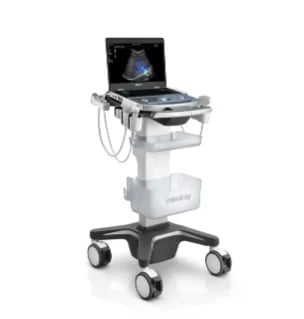 Portable ultrasound machine on wheeled stand with laptop display showing medical imaging