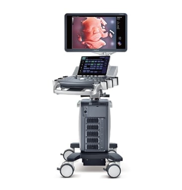 Medical ultrasound machine on wheeled cart with display monitor and keyboard showing fetal imaging