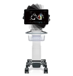 Medical ultrasound machine on mobile stand with black monitor display and white cart base