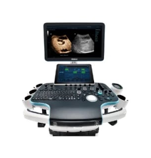 Medical ultrasound machine with display monitor showing fetal imaging and control console with buttons and trackball