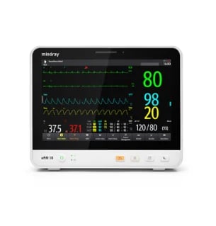 Mindray patient monitor displaying vital signs including heart rate at 80 bpm, blood pressure at 120/80 mmHg, and waveform tracings on black screen