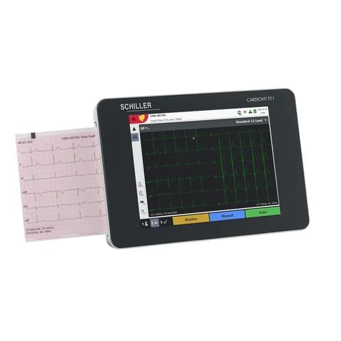 Schiller portable ECG device displaying cardiac waveforms on screen with printed ECG paper readout visible on the left