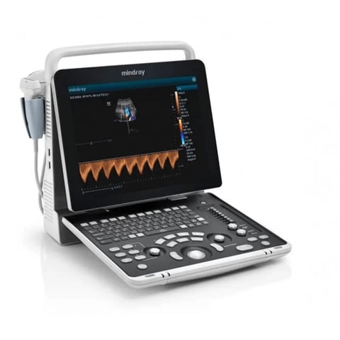 Portable ultrasound machine with touchscreen display showing waveform and 3D imaging data, featuring control panel with buttons and knobs