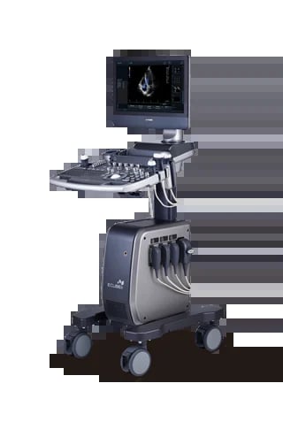 Medical ultrasound machine on wheeled cart with monitor displaying ultrasound image and control panel