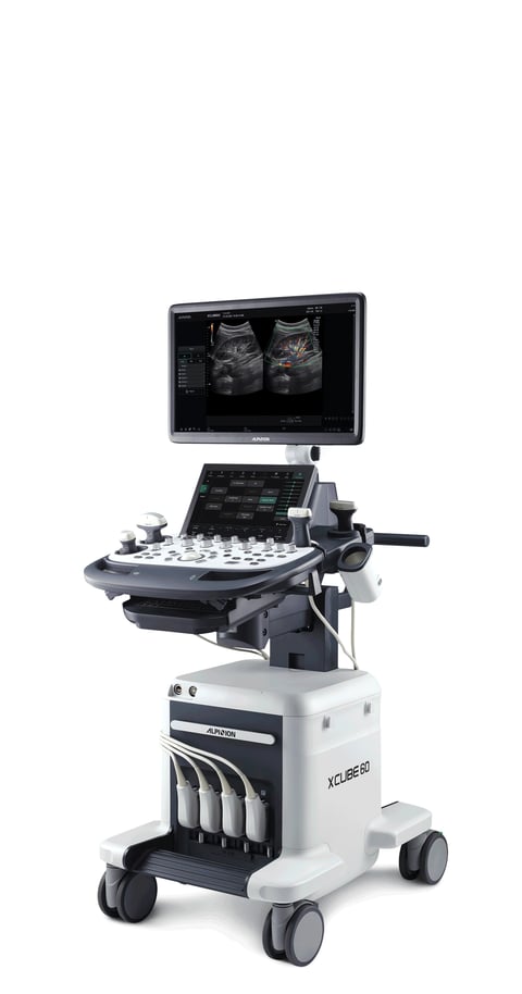 Medical ultrasound machine on wheeled cart with keyboard control panel and dual monitor display showing sonogram images