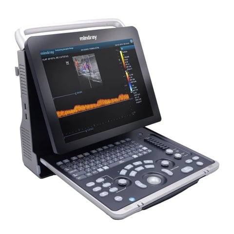 Mindray portable ultrasound machine with LCD display showing waveforms and control panel with buttons