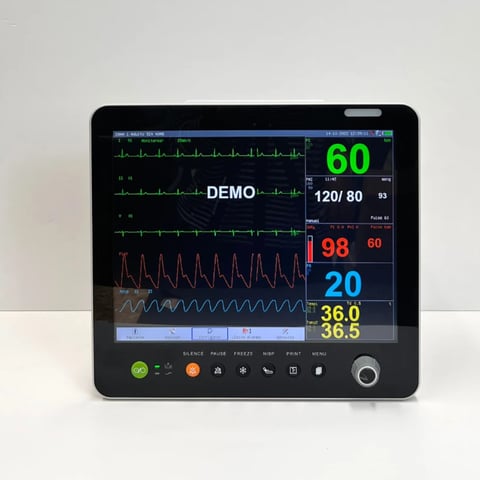 Medical monitor displaying vital signs including heart rate of 60 bpm, blood pressure 120/80, oxygen saturation 98%, and temperature readings