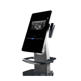 Medical ultrasound machine on stand with display screen showing ultrasound imagery
