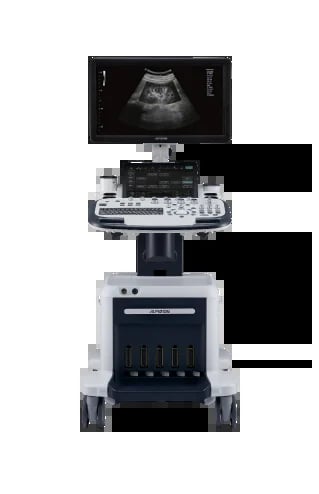Ultrasound machine with monitor displaying a fetal ultrasound image, control panel with buttons, and mobile stand base