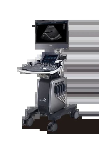 Medical ultrasound machine on wheeled cart with monitor displaying grayscale ultrasound image